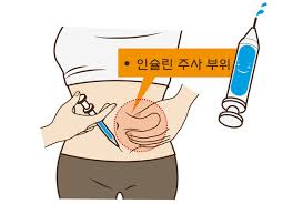 인슐린 약물보관법 부작용주의사항 저혈당 새벽현상 소모기현상 응급대처방법 인슐린 약물보관법 부작용주의사항 저혈당 새벽현상 소모기현상 응급대처방법