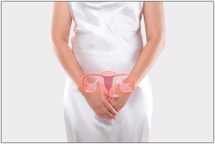  초콜릿낭종, 치료 시기 놓쳐서 난임 유산되는 환자 특징?