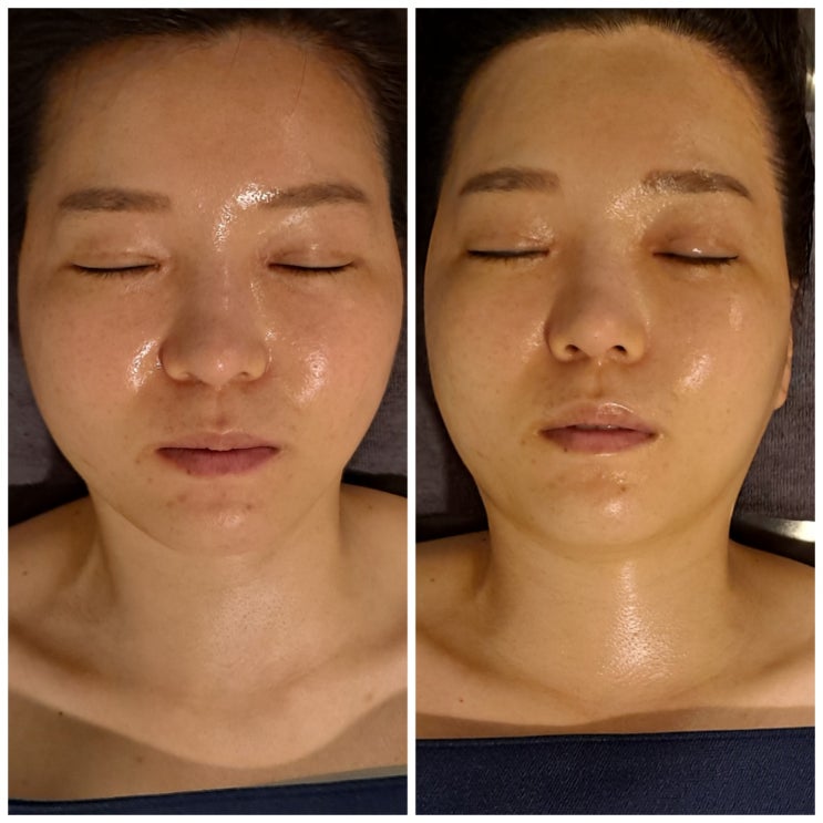  대치동피부관리 에스테디아의 촉촉한 윤곽관리