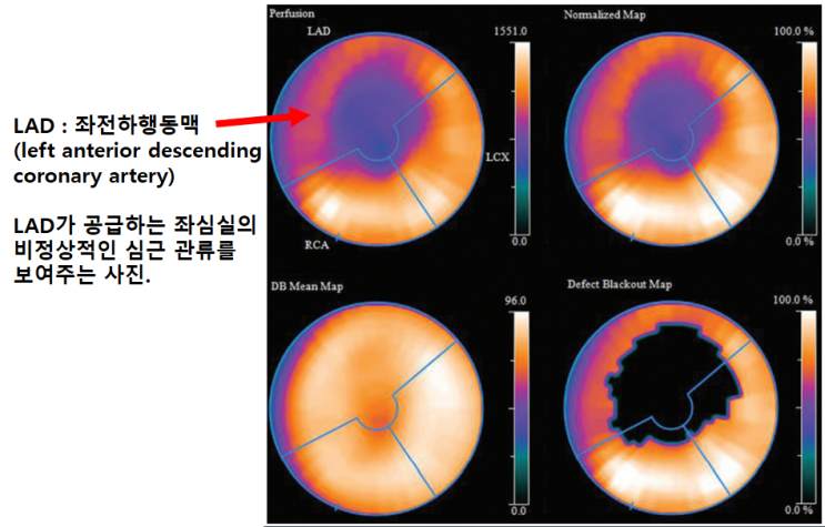  의학에서 활용되는 물리/화학 (1) 동위원소와 의학