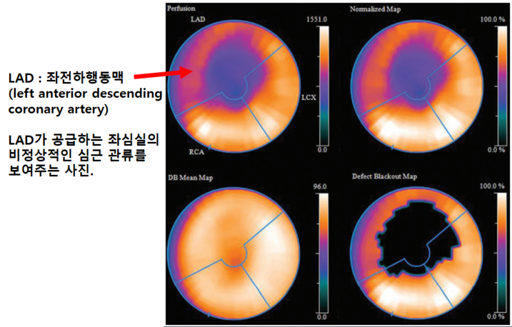 의학에서 활용되는 물리/화학 (1) 동위원소와 의학