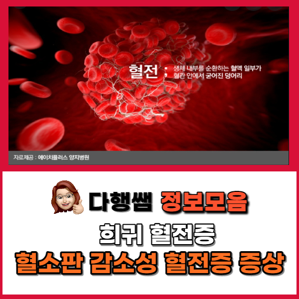  희귀 혈전증이란? 혈소판 감소성 혈전증 증상 30대 백신부작용 연관성 첫 인정