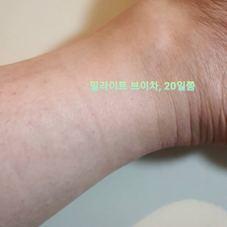  아침 얼굴 붓기빼고, 하체부종 관리하는 오늘.