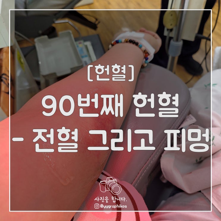  [헌혈] 90번째 헌혈 그리고 피멍 [전혈 / 운동 / 멍]