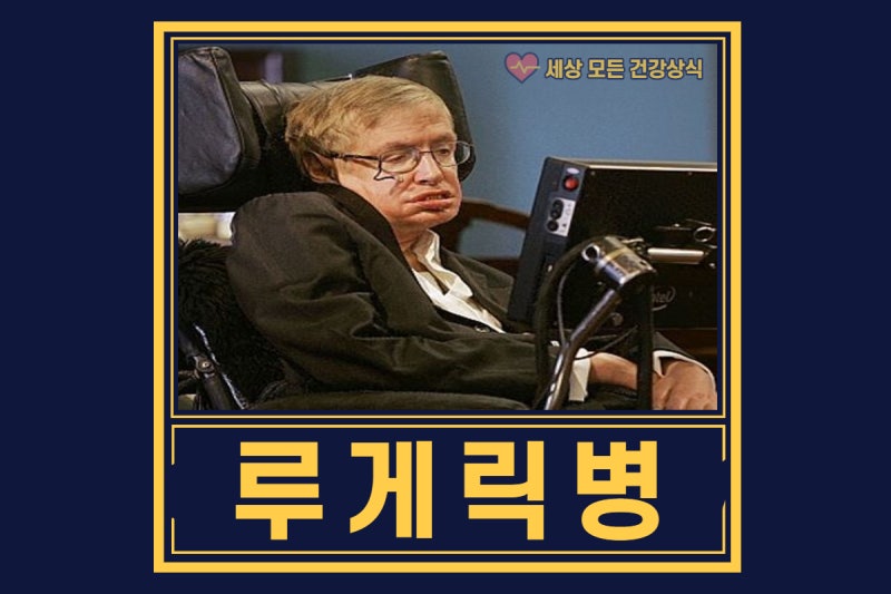루게릭병 초기증상 및 자가진단방법, 치료제 개발 어디까지 왔나? : 네이버 블로그