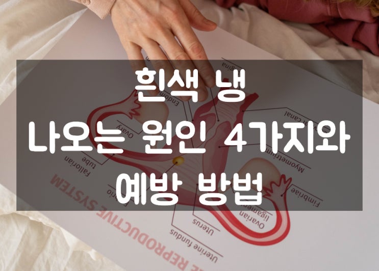  흰색 냉 나오는 원인 4가지와 예방 방법