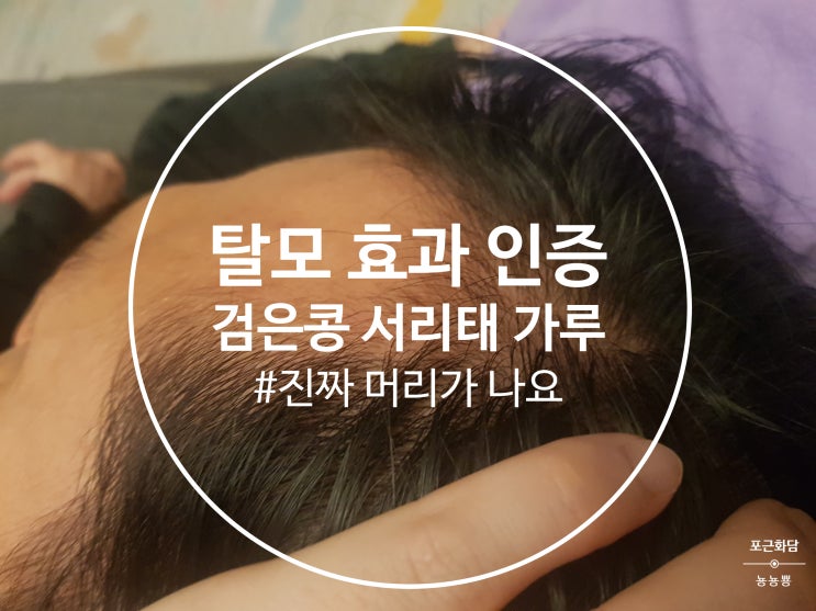  검은콩 서리태 가루 효과 탈모에 최고/ 남편 머리가 자라고 있어요. (사진인증)