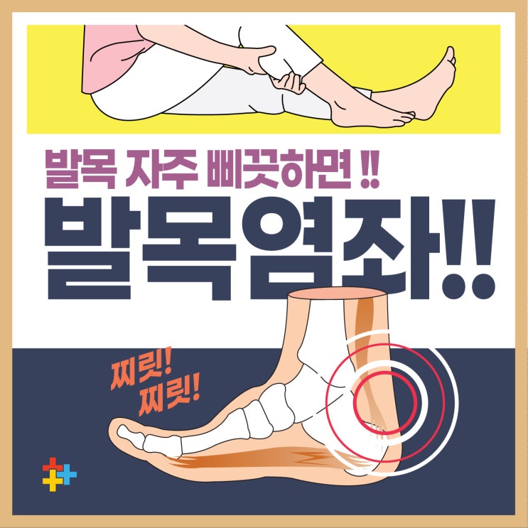  은평구신경외과, 흔히 발생하는 발목통증 원인