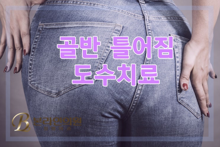  골반틀어짐으로 골반통증과 더불어 어깨통증유발, 심하면 척추까지 틀어져
