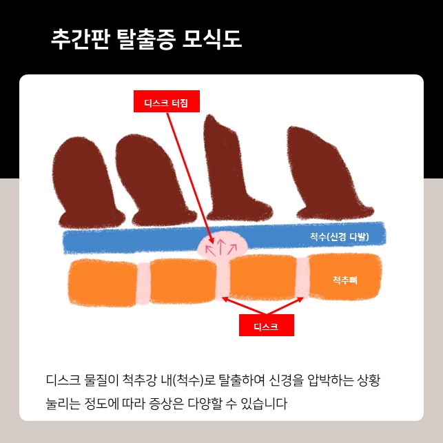  강아지 목 디스크 증상? 발산역 동물병원