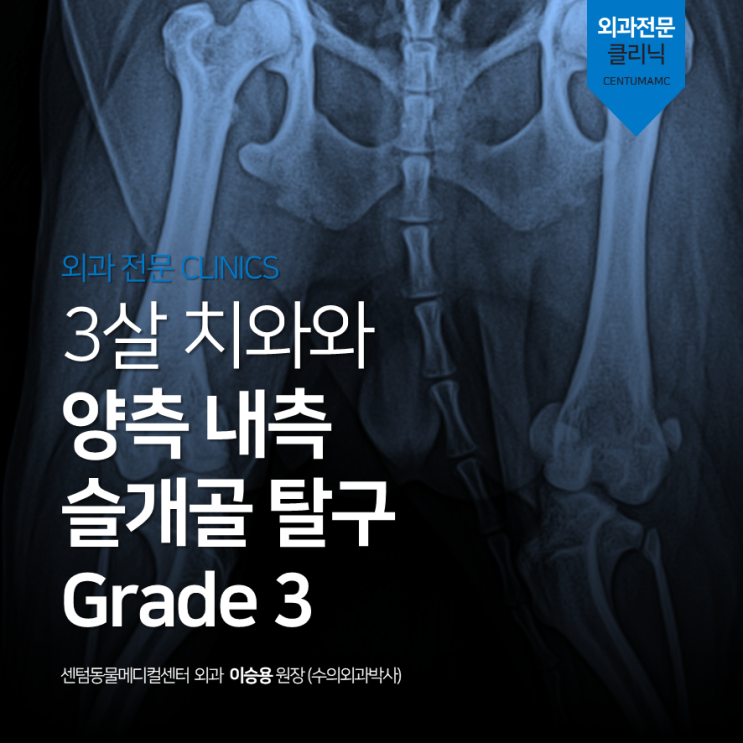 3살 치와와 양측 내측 슬개골 탈구 ,Grade 3 (부산 외과 박사 수술 동물병원 센텀동물메디컬센터)