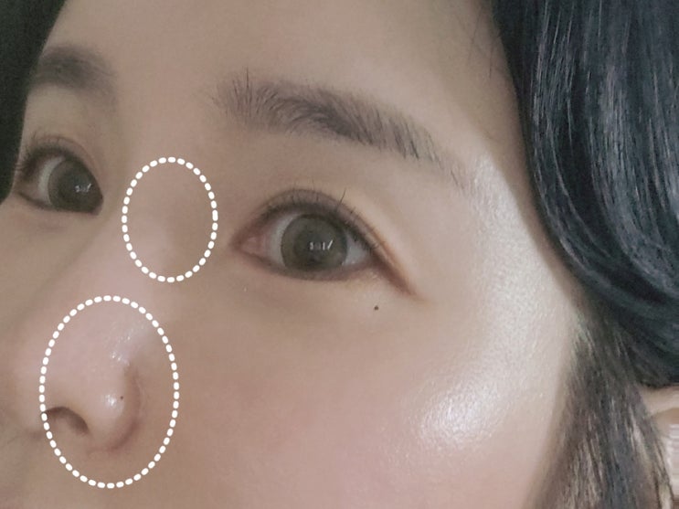 코집게 코높이 교정기 진짜 효과 있나? 코집게 코높이 교정기 진짜 효과 있나?