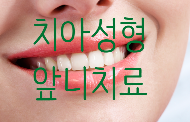  당감동치과 감동의 치아성형 앞니치료