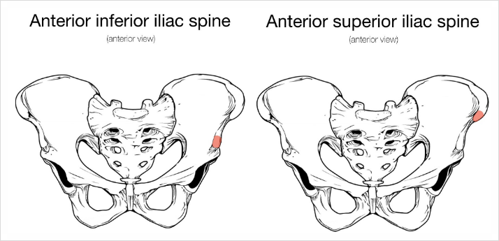 [X-ray] 골반 Pelvis X-ray : 네이버 블로그