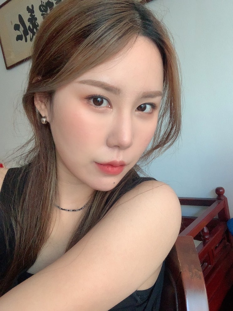  광화문피부과 아꼴레이드 색소침착 잡티레이저 2회차 리얼후기