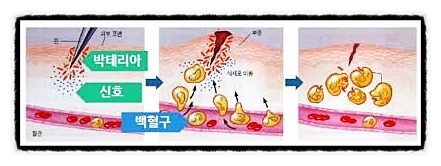 혈액 유해 물질 백혈구 시스템 미생물 독소 림프구 고름 콧물 상처