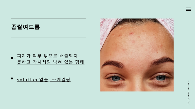 오돌토돌한 요철 피부 원인 4가지 : 네이버 블로그