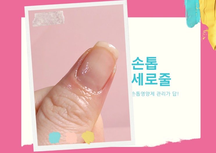 손톱 세로줄 손톱영양제 사용 발톱 까지 걱정 덜었어요 ! 손톱 세로줄 손톱영양제 사용 발톱 까지 걱정 덜었어요 !