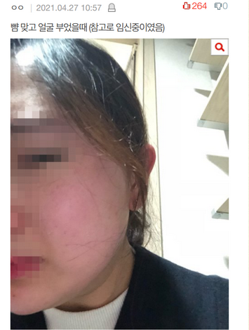부산 결혼식장 불륜 대구 상간녀 결혼식 후기 부산 결혼식장 불륜 대구 상간녀 결혼식 후기