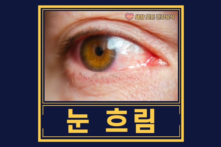  한쪽눈이 흐릿한 원인과 해결방안 ( 뿌옇게, 시력저하 )