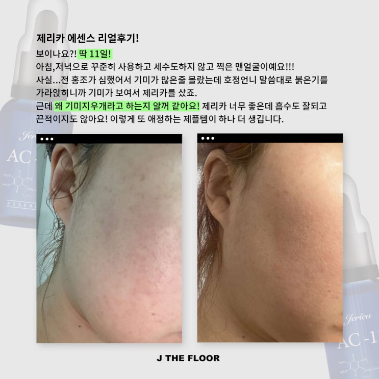  <커밍쑨> 제리카 에센스 _