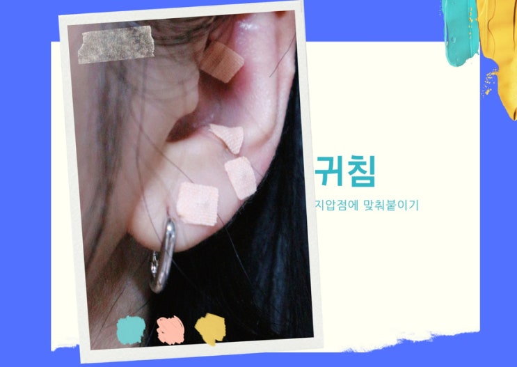 귀침 귀 지압점 패치 호기심에 붙여봤다 ! 귀침 귀 지압점 패치 호기심에 붙여봤다 !