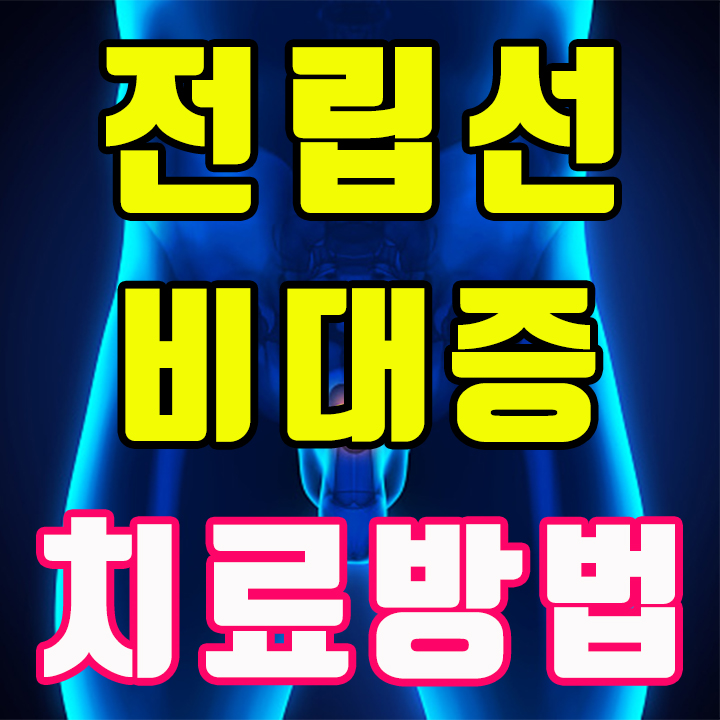  전립선비대증치료방법 및 원인과 증상 알아보기