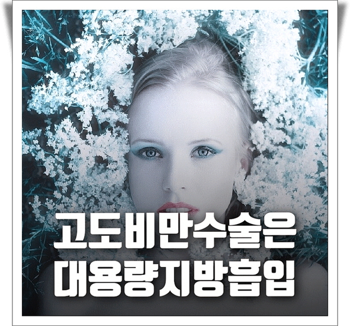 고도비만수술은 대용량지방흡입 고도비만수술은 대용량지방흡입