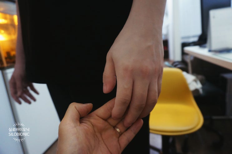  손목절단&흉터 커버, 팔꿈치까지 끼우는  실리콘 맞춤형 의수 제작