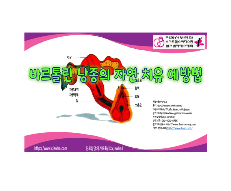 바르톨린낭종 자연치유
