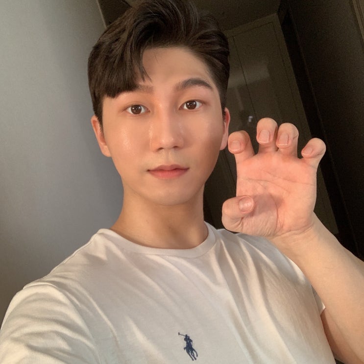 손톱 검은세로줄 원인? 해결법?