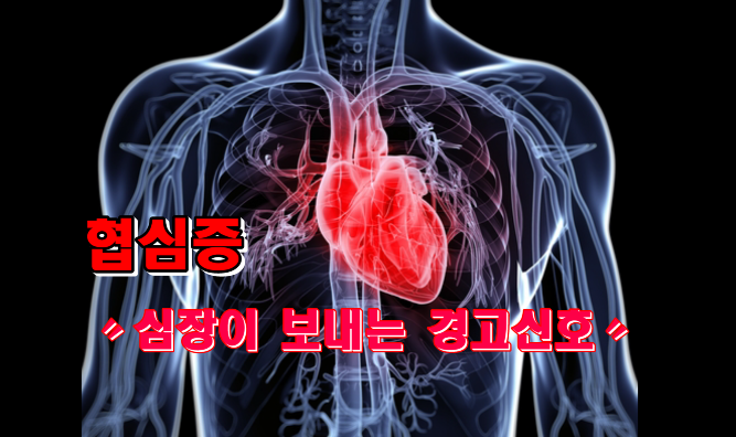 협심증 원인과 예방｜심장이 보내는 경고신호!?