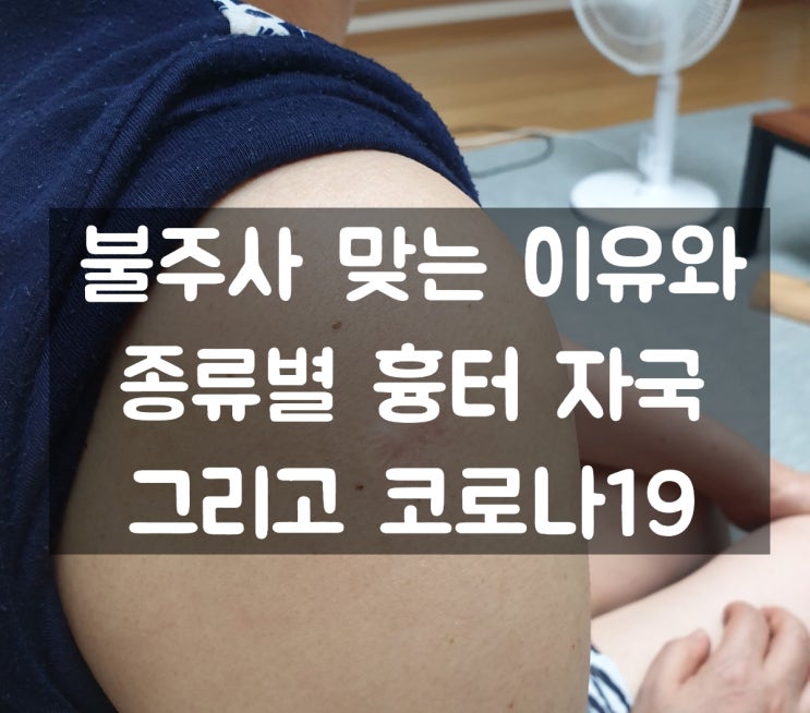  불주사 맞는 이유와 종류별 흉터 자국 그리고 코로나
