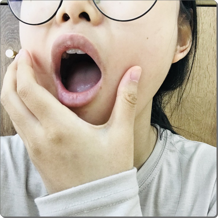  구취원인 몰랐다면 읽어봐!
