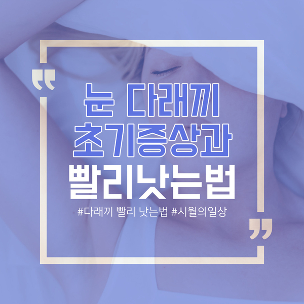  눈 다래끼 빨리 낫는 법과 초기 증상 그리고 전염