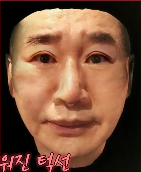 최양락 쌍커플(쌍커풀) 병원 위치, 전후 모습 최양락 쌍커플(쌍커풀) 병원 위치, 전후 모습