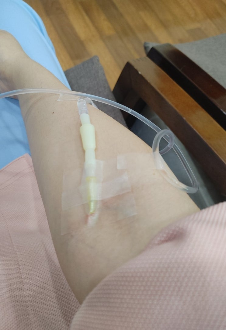  [둔산속편한내과] 건강검진 대장내시경 후기