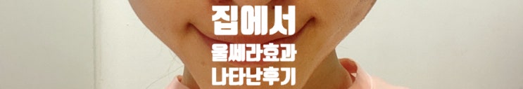  가정용 울쎄라 발견 뉴스킨 페이스 갈바닉 내돈내산 홈케어 즉각결과