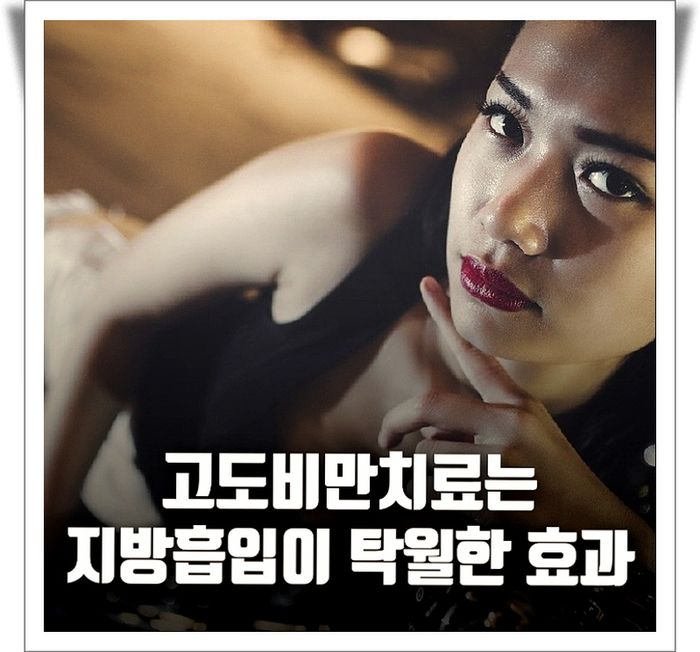  고도비만치료는 지방흡입이 탁월한 효과