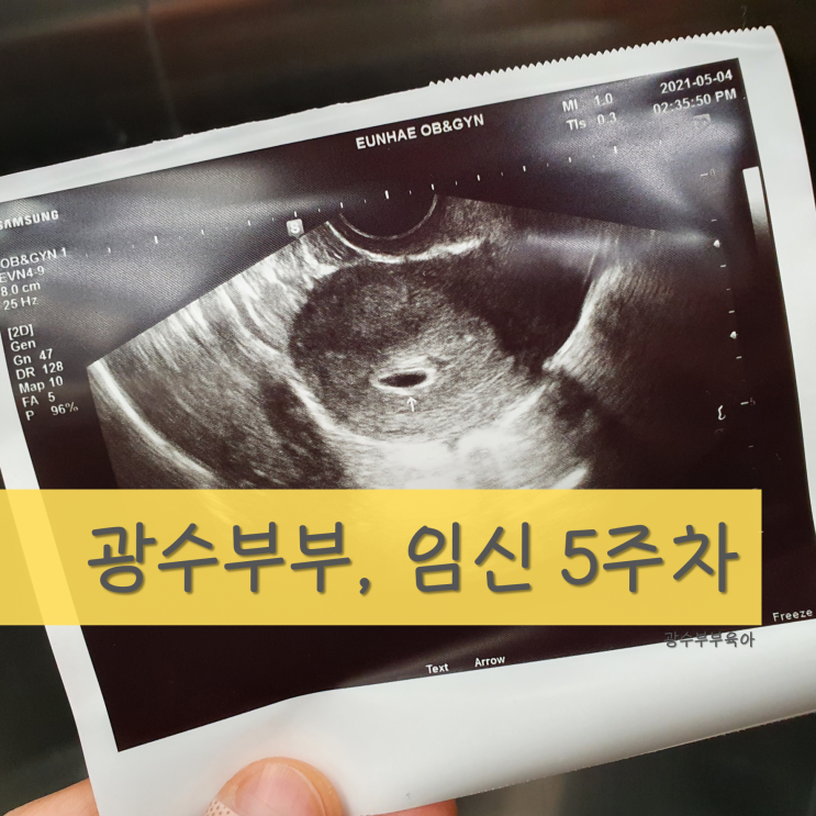  [육아] 임신 5주차 : 아기집(태낭)을 보고온 날 : 광수부부 드디어 안심!
