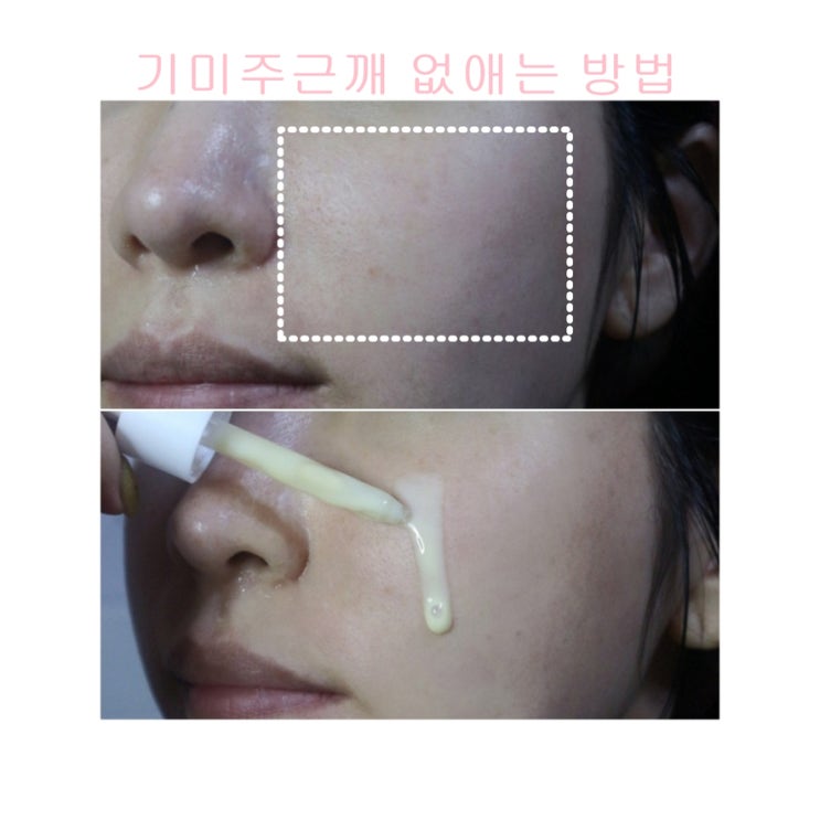 주근깨 없애는법 기미 잡티팩 검버섯 피부 토닝 크림 얼굴 손등 제거 다해봄 주근깨 없애는법 기미 잡티팩 검버섯 피부 토닝 크림 얼굴 손등 제거 다해봄