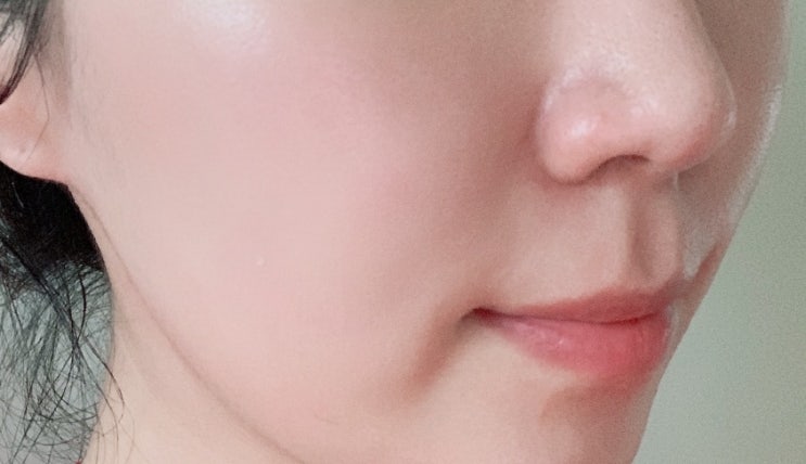  강남 다시봄날의원 더블로골드 리프팅 300샷 후기