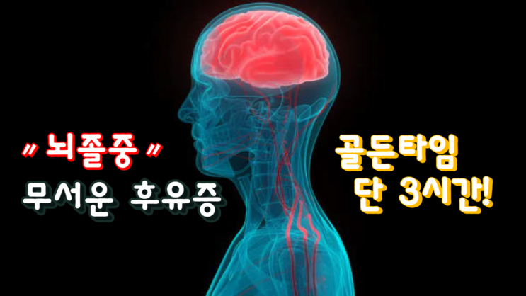  뇌졸중 원인과 예방, 증상은?｜골든타임 단 3시간!