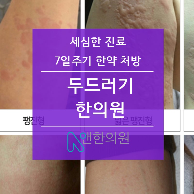 From treatment to life management at the Dudeulgi Oriental Medicine Clinic in Ulsan 4
