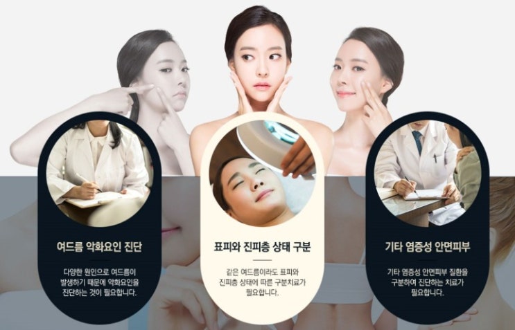  명동 등여드름, 가슴 여드름 줄이는 생활 속 관리