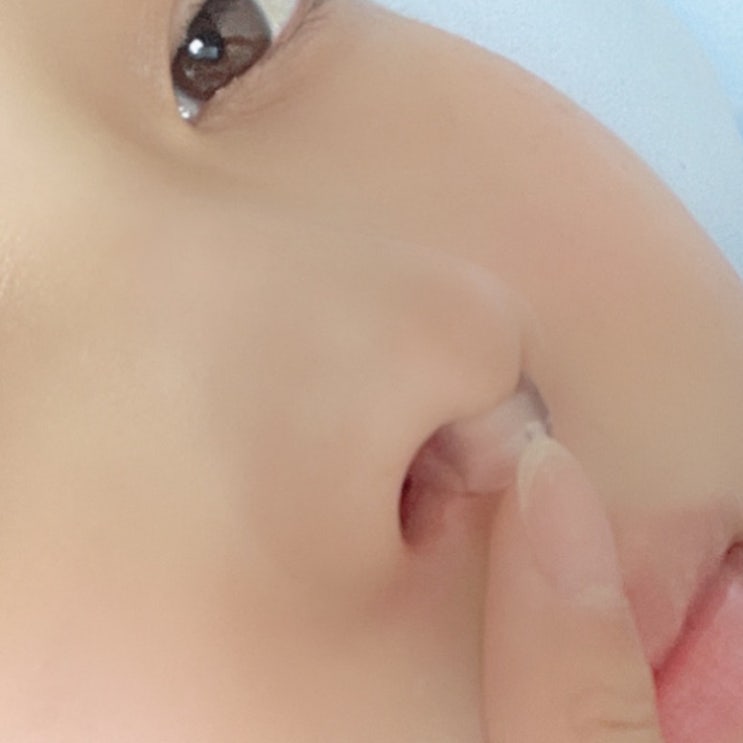비강확장기 아프지 않은걸로 찾아봄 비강확장기 아프지 않은걸로 찾아봄