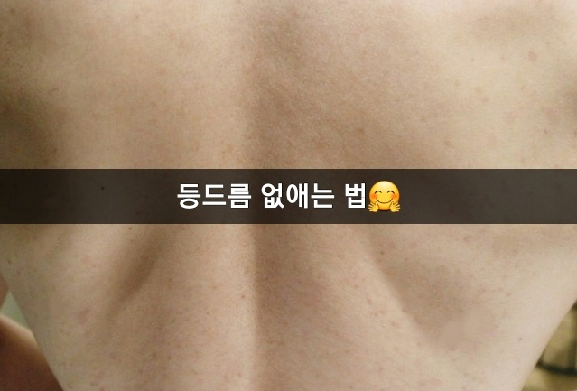 등드름 없애는 법 원인 찾고 등여드름 피지 잡고 흉터 비누와 복합 관리 ! 등드름 없애는 법 원인 찾고 등여드름 피지 잡고 흉터 비누와 복합 관리 !