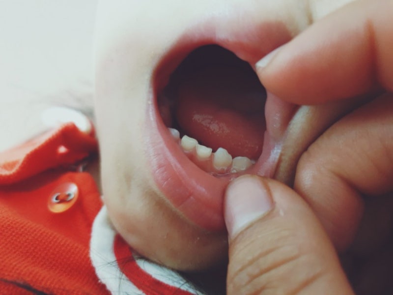 세돌 아기 가구 가구 강 요청+ 불소 Poigi Magog Hyo & Jr. 유아 치과 진료소