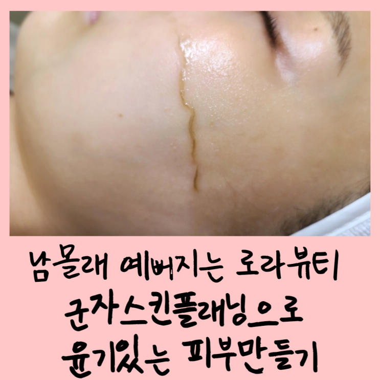  남몰래 예뻐지는 로라뷰티 : 군자스킨플래닝으로 윤기있는 피부만들기