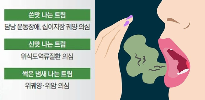  잦은 트림 자주 하는 이유 (ft. 신맛 쓴맛 썩은 냄새 질환 치료법) 아이 유아 트름